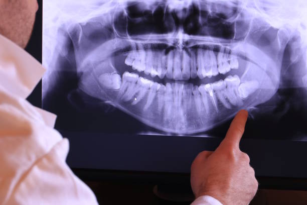 Best Chipped Tooth Repair Near Me  in Monticello, KY