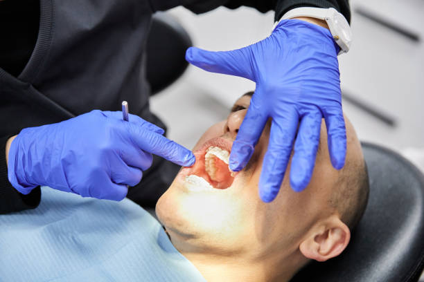 Best Dentist for Tooth Abscess  in Monticello, KY