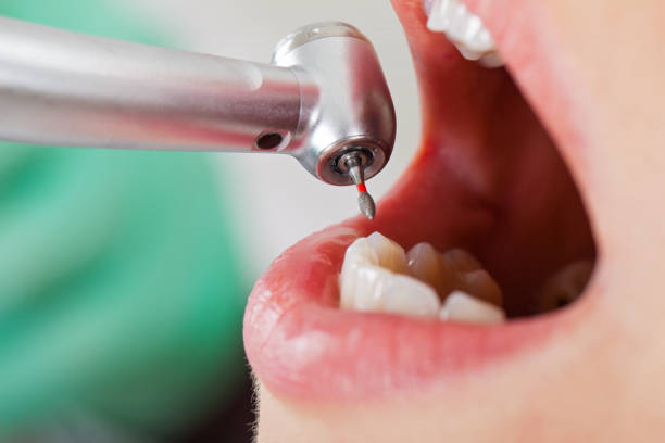 Best Urgent Tooth Repair  in Monticello, KY